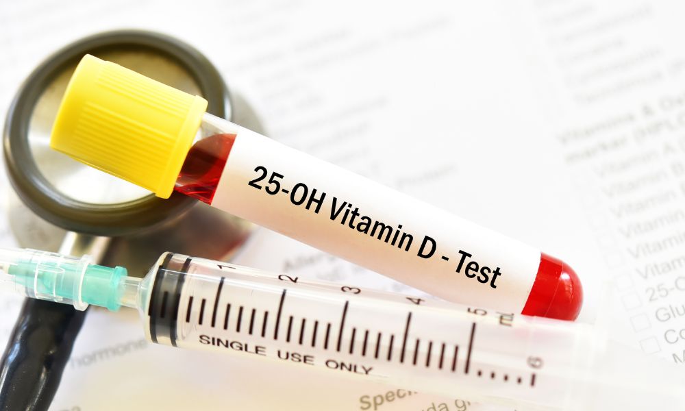 badanie poziomu witaminy d3
