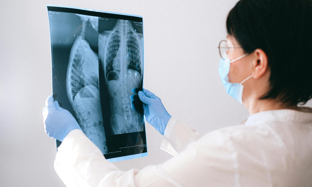 lekarz analizujący RTG pacjenta