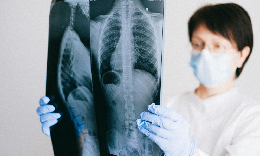 Lekarka oglądająca zdjęcie RTG pacjenta