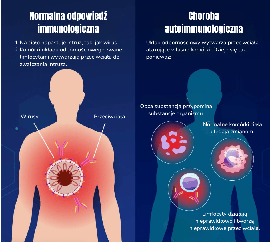 Jak działają choroby autoimmunologiczne